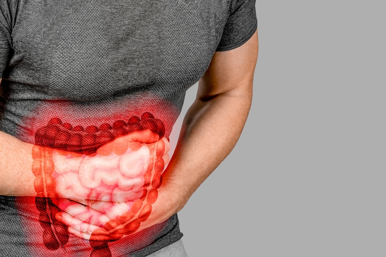  Síndrome del intestino irritable: estreñimiento