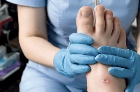 Heridas isquémicas y mixtas: claves para reconocer un problema vascular